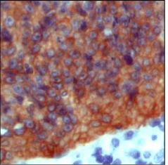 Cytokeratin 20 Antibody in Immunohistochemistry (Paraffin) (IHC (P))