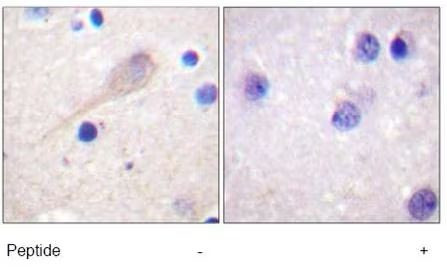 Parkin Antibody in Immunohistochemistry (Paraffin) (IHC (P))