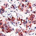 Prolactin Antibody in Immunohistochemistry (Paraffin) (IHC (P))