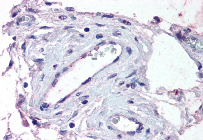 ADAMTS1 Antibody in Immunohistochemistry (Paraffin) (IHC (P))