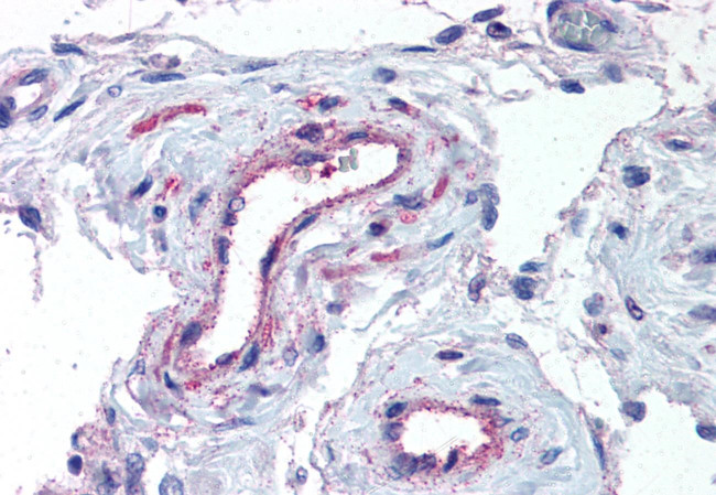 ADAMTS1 Antibody in Immunohistochemistry (Paraffin) (IHC (P))