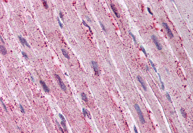 ADAMTS4 Antibody in Immunohistochemistry (Paraffin) (IHC (P))