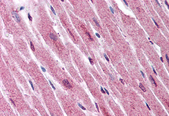 ADAMTS4 Antibody in Immunohistochemistry (Paraffin) (IHC (P))