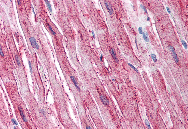 ADAMTS4 Antibody in Immunohistochemistry (Paraffin) (IHC (P))