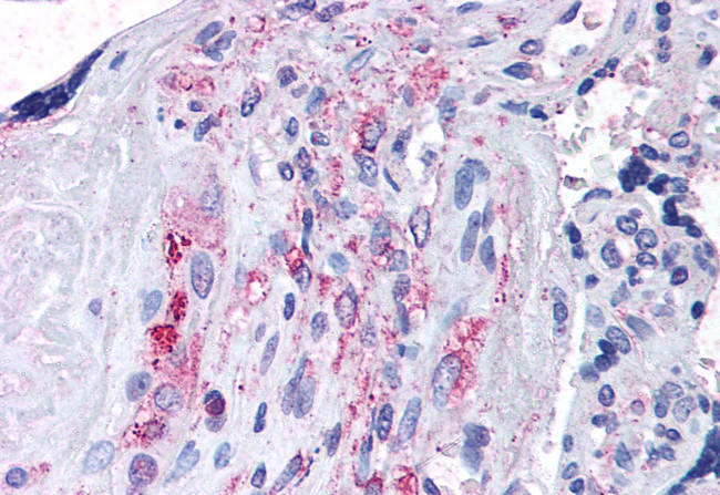 ADAMTS5 Antibody in Immunohistochemistry (Paraffin) (IHC (P))