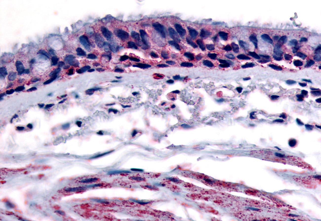 AHR Antibody in Immunohistochemistry (Paraffin) (IHC (P))