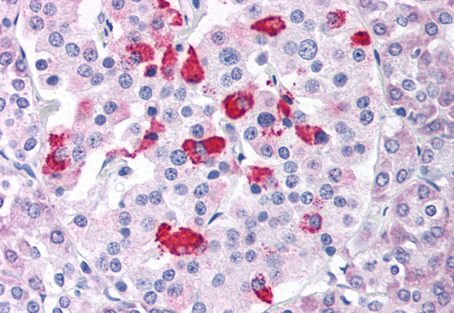 BACE1 Antibody in Immunohistochemistry (Paraffin) (IHC (P))