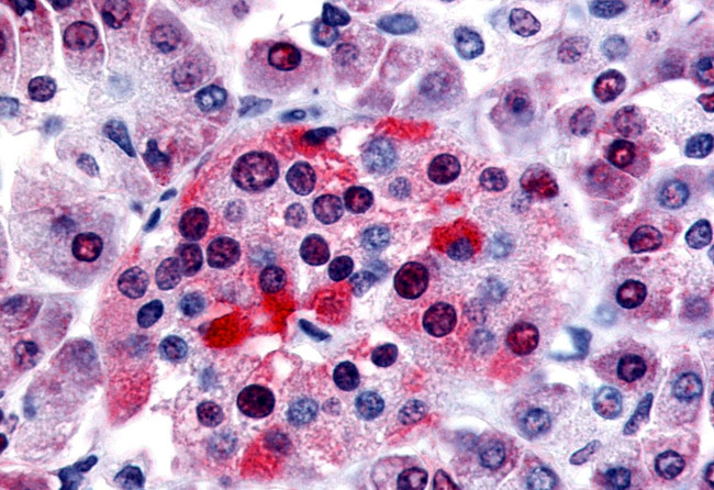 Bombesin Receptor 3 Antibody in Immunohistochemistry (Paraffin) (IHC (P))