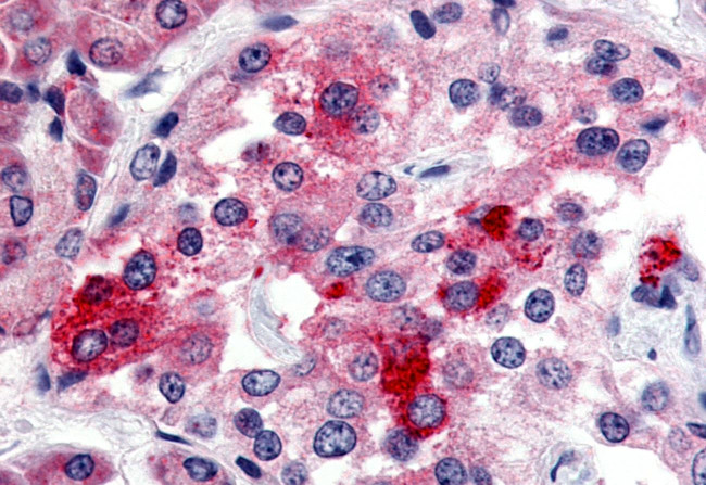 Bombesin Receptor 3 Antibody in Immunohistochemistry (Paraffin) (IHC (P))