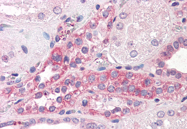 C14orf1 Antibody in Immunohistochemistry (Paraffin) (IHC (P))