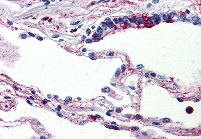 C5AR1 Antibody in Immunohistochemistry (Paraffin) (IHC (P))