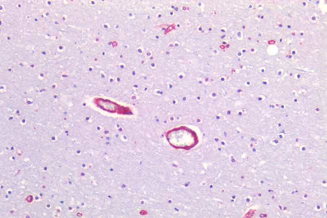 Caveolin 1 Antibody in Immunohistochemistry (Paraffin) (IHC (P))