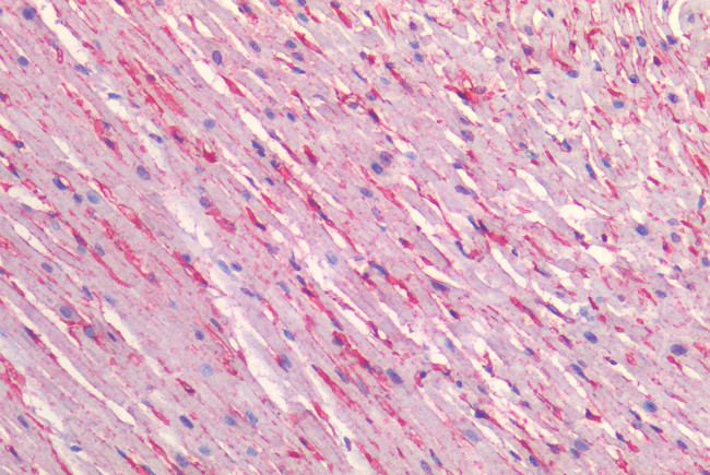 Caveolin 1 Antibody in Immunohistochemistry (Paraffin) (IHC (P))