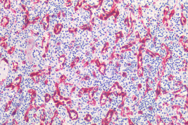 Caveolin 1 Antibody in Immunohistochemistry (Paraffin) (IHC (P))