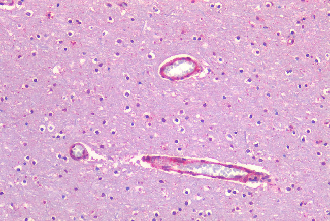 Caveolin 1 Antibody in Immunohistochemistry (Paraffin) (IHC (P))