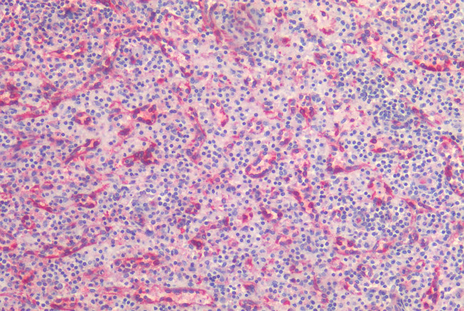 Caveolin 1 Antibody in Immunohistochemistry (Paraffin) (IHC (P))