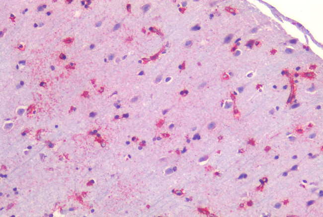 Caveolin 1 Antibody in Immunohistochemistry (Paraffin) (IHC (P))