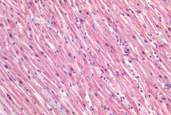 Caveolin 1 Antibody in Immunohistochemistry (Paraffin) (IHC (P))