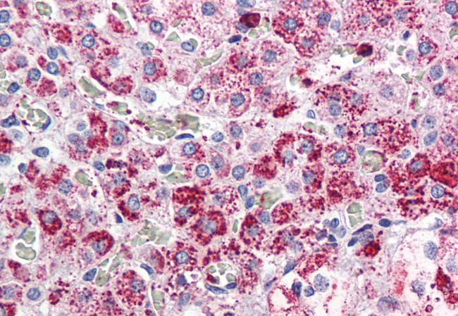 CCKAR Antibody in Immunohistochemistry (Paraffin) (IHC (P))