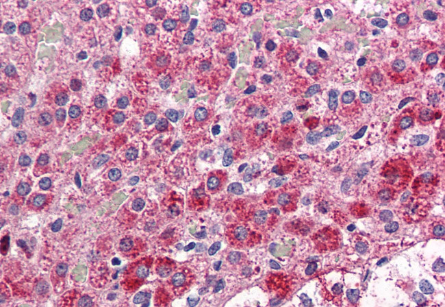 CCKAR Antibody in Immunohistochemistry (Paraffin) (IHC (P))