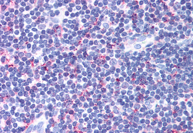 CCR4 Antibody in Immunohistochemistry (Paraffin) (IHC (P))