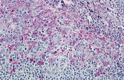 CCR8 Antibody in Immunohistochemistry (Paraffin) (IHC (P))