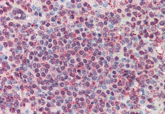 CD70 Antibody in Immunohistochemistry (Paraffin) (IHC (P))