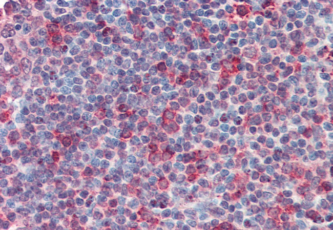 CD70 Antibody in Immunohistochemistry (Paraffin) (IHC (P))