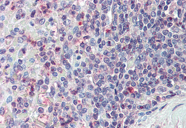 CD70 Antibody in Immunohistochemistry (Paraffin) (IHC (P))