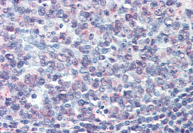 CD70 Antibody in Immunohistochemistry (Paraffin) (IHC (P))