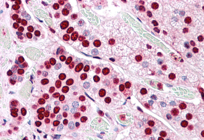 COMT Antibody in Immunohistochemistry (Paraffin) (IHC (P))