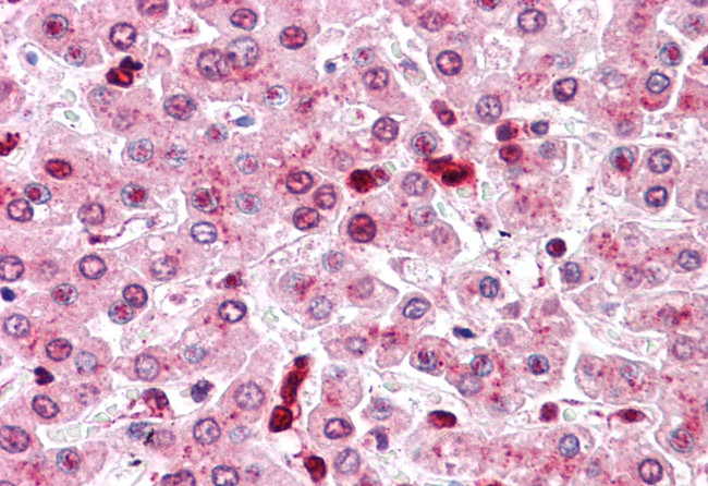 COMT Antibody in Immunohistochemistry (Paraffin) (IHC (P))