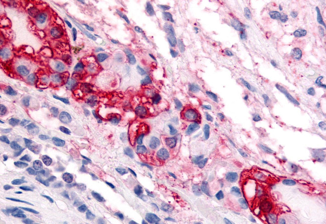 CRHR1 Antibody in Immunohistochemistry (Paraffin) (IHC (P))