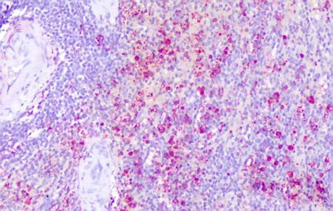 CX3CR1 Antibody in Immunohistochemistry (Paraffin) (IHC (P))