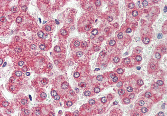 CAR Antibody in Immunohistochemistry (Paraffin) (IHC (P))