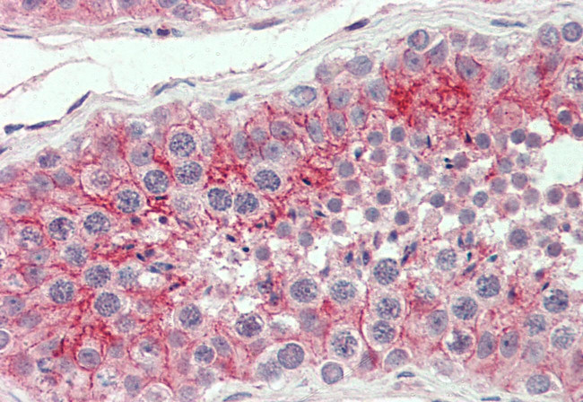 CAR Antibody in Immunohistochemistry (Paraffin) (IHC (P))