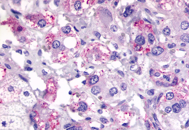 CXCR2 Antibody in Immunohistochemistry (Paraffin) (IHC (P))