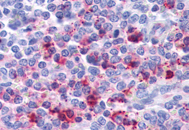 CXCR2 Antibody in Immunohistochemistry (Paraffin) (IHC (P))