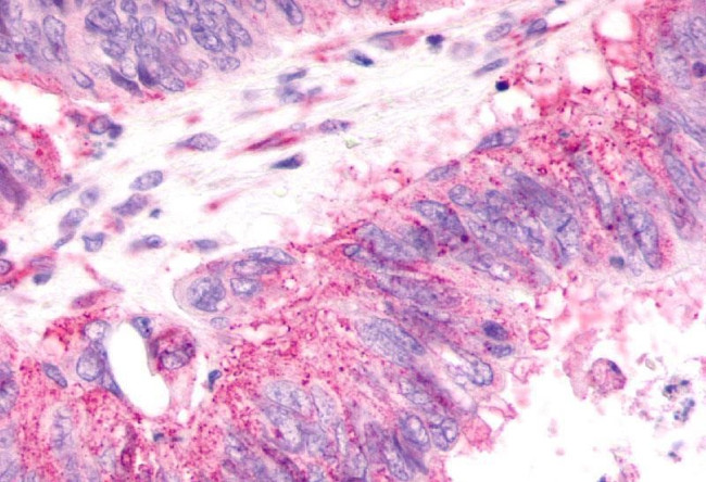 CXCR2 Antibody in Immunohistochemistry (Paraffin) (IHC (P))