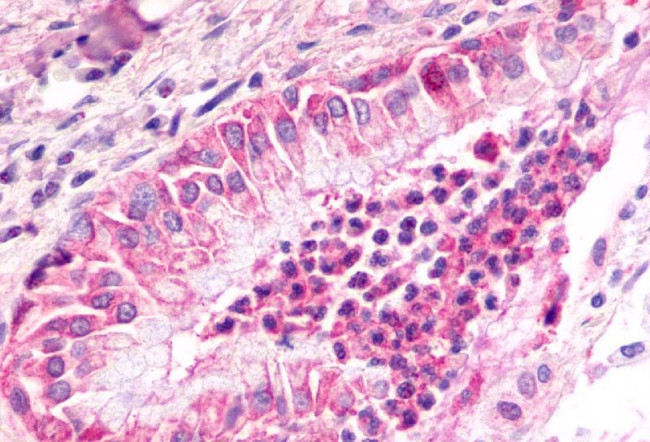 CXCR2 Antibody in Immunohistochemistry (Paraffin) (IHC (P))