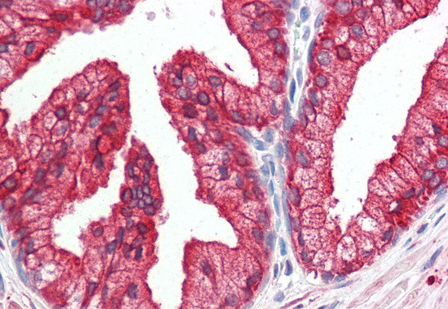 DHRS7 Antibody in Immunohistochemistry (Paraffin) (IHC (P))