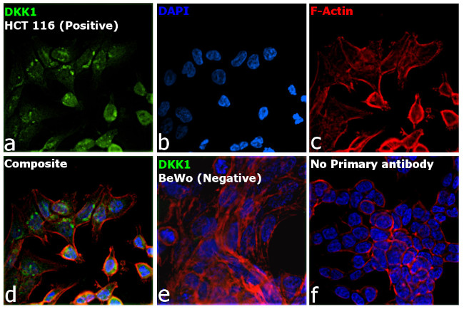 DKK1 Antibody