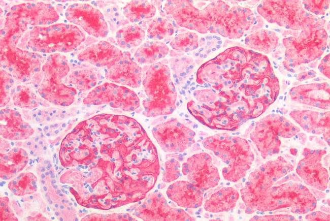 CD26 Antibody in Immunohistochemistry (Paraffin) (IHC (P))