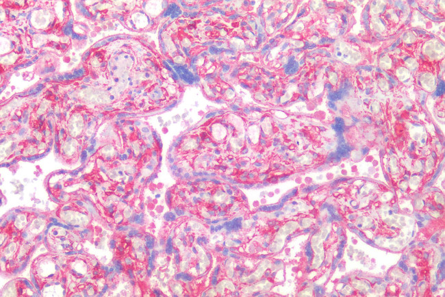 CD26 Antibody in Immunohistochemistry (Paraffin) (IHC (P))