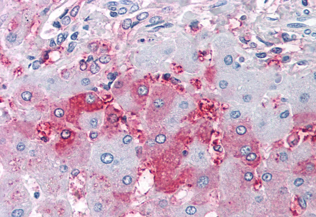 DUSP26 Antibody in Immunohistochemistry (Paraffin) (IHC (P))