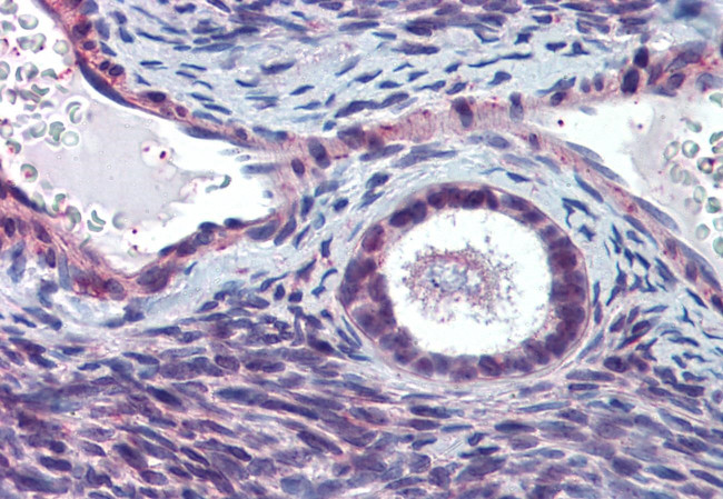 ELOVL5 Antibody in Immunohistochemistry (Paraffin) (IHC (P))