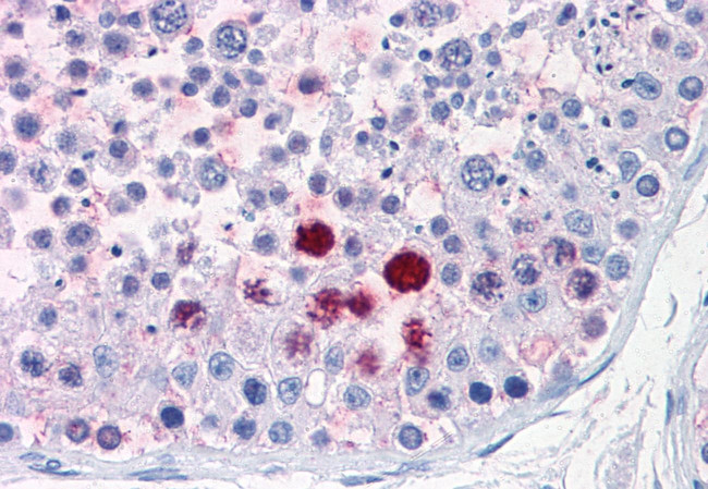 CD203c Antibody in Immunohistochemistry (Paraffin) (IHC (P))