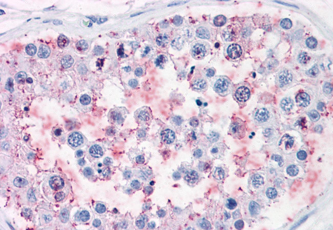 CD203c Antibody in Immunohistochemistry (Paraffin) (IHC (P))