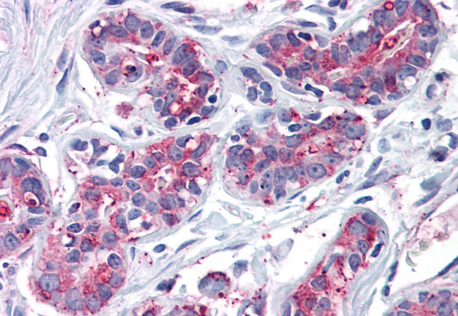 ENTPD2 Antibody in Immunohistochemistry (Paraffin) (IHC (P))