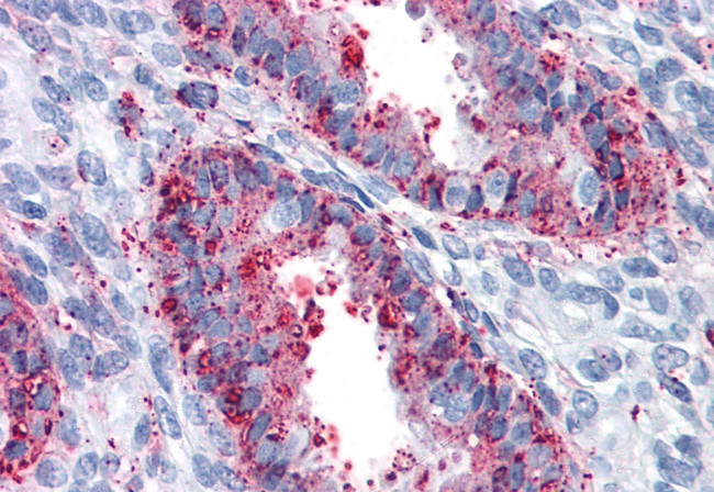 ENTPD2 Antibody in Immunohistochemistry (Paraffin) (IHC (P))